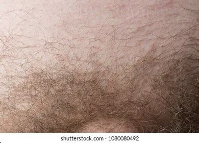 nude pubic hair|Category : Pubic hair (female) by color